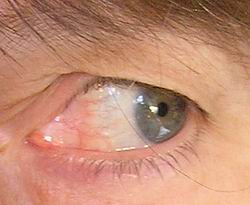 rood-oog.JPG